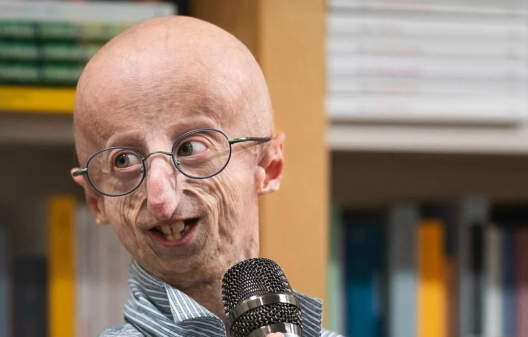 Sammy Basso, Penyintas Progeria Terlama di Dunia, Meninggal Dunia pada Usia 28 Tahun